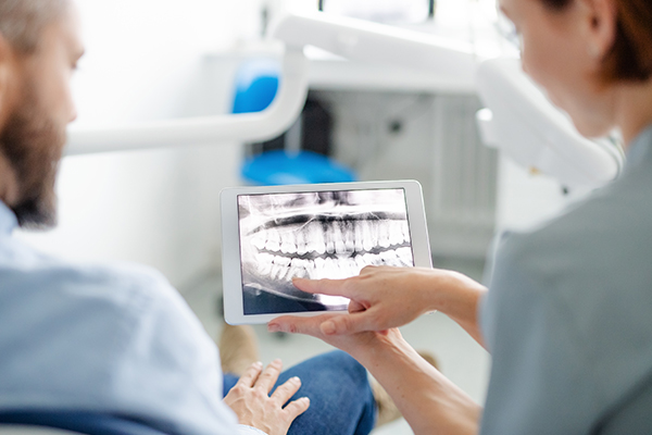 Chirurgia dentale e orale: cos’è e quando è necessaria?