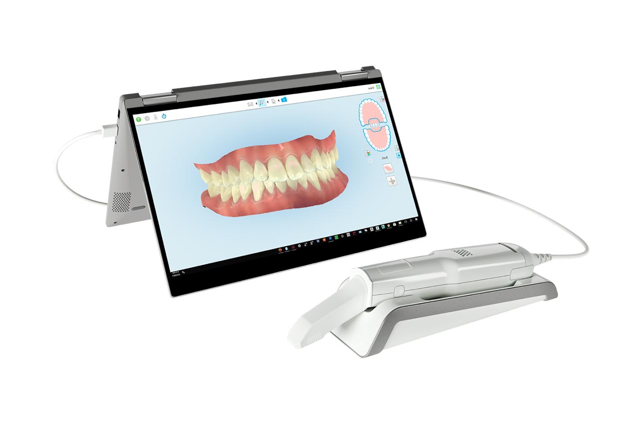 scanner--dentale-3d